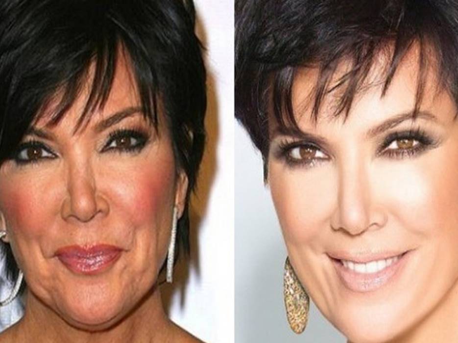 Kris Jenner Before and After
