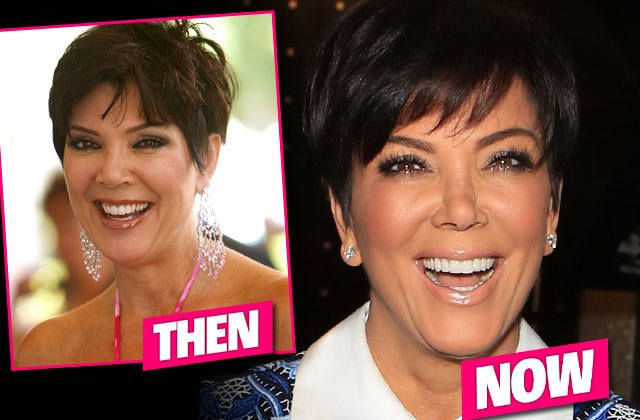 Kris Jenner Before and After